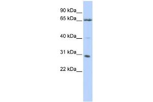 WB Suggested Anti-GRHL1 Antibody Titration:  0.