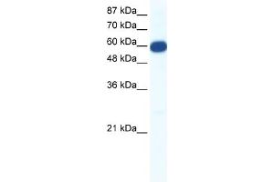 WB Suggested Anti-SLC18A1 Antibody Titration:  0. (SLC18A1 anticorps  (N-Term))