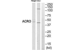 Western Blotting (WB) image for anti-Acrosin (ACR) (Cleaved-Ile43), (N-Term) antibody (ABIN1853476)