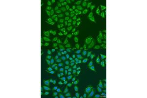 Immunofluorescence analysis of U2OS cells using B1 antibody (ABIN7265534) at dilution of 1:100.