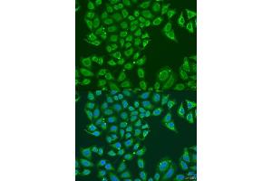 Immunofluorescence analysis of U2OS cells using B1 antibody (ABIN7265534) at dilution of 1:100. (ALDH1B1 anticorps  (AA 278-517))