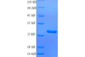 SDS-PAGE (SDS) image for S100 Calcium Binding Protein A4 (S100A4) (AA 2-101) protein (His-SUMO Tag) (ABIN5710296)