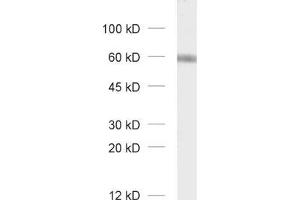 dilution: 1 : 1000, sample: unboiled synaptic membrane fraction of rat brain (LP1) (GABRA3 anticorps  (AA 29-43))