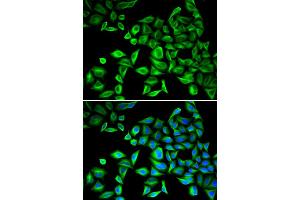 Immunofluorescence analysis of HeLa cells using CRP antibody. (CRP anticorps)
