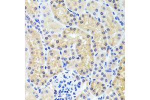 Immunohistochemistry of paraffin-embedded mouse kidney using INADL antibody at dilution of 1:100 (x40 lens). (PATJ anticorps)