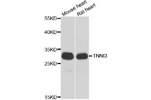 Western blot analysis of extracts of various cell lines, using TNNI3 antibody.