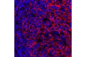 Immunofluorescence (IF) image for anti-Membrane-Spanning 4-Domains, Subfamily A, Member 1 (MS4A1) antibody (ABIN7449560) (CD20 anticorps)