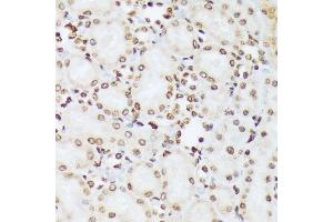 Immunohistochemistry of paraffin-embedded rat kidney using Phospho-c-Abl-Y412 antibody (ABIN7265966) at dilution of 1:100 (40x lens). (ABL1 anticorps  (pTyr412))