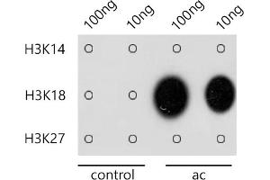 Dot-blot analysis of all sorts of methylation peptides using Acetyl-Histone H3-K18 antibody (ABIN7267668) at 1:1000 dilution.