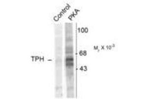 Image no. 1 for anti-Tryptophan Hydroxylase 1 (TPH1) (pSer58) antibody (ABIN227714)