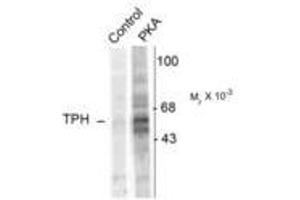 Image no. 1 for anti-Tryptophan Hydroxylase 1 (TPH1) (pSer58) antibody (ABIN227714) (Tryptophan Hydroxylase 1 anticorps  (pSer58))