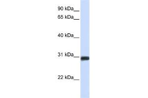 WB Suggested Anti-BARX2 Antibody Titration:  0. (BARX Homeobox 2 anticorps  (N-Term))