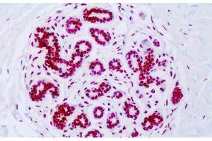 Image no. 3 for anti-Histone H3 (H3) (H3K18ac) antibody (ABIN2879163) (Histone 3 anticorps  (H3K18ac))