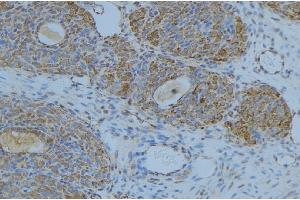 ABIN6276676 at 1/100 staining Human uterus tissue by IHC-P. (LIPC anticorps  (Internal Region))