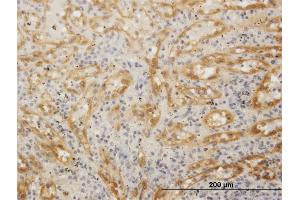 Immunoperoxidase of purified MaxPab antibody to FHOD1 on formalin-fixed paraffin-embedded human spleen. (FHOD1 anticorps  (AA 1-1164))