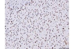 IHC analysis of TPR using anti-TPR antibody (ABIN7603243). (TPR anticorps  (N-Term))