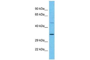 Host: Rabbit Target Name: OR2A25 Sample Type: Placenta lysates Antibody Dilution: 1. (OR2A25 anticorps  (C-Term))