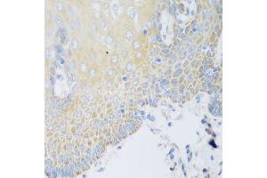 Immunohistochemistry of paraffin-embedded human esophagus using DHODH antibody.
