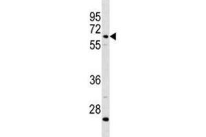 C8B antibody western blot analysis in CEM lysate (C8B anticorps  (AA 393-422))