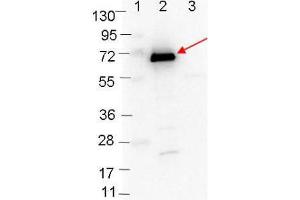 Western blot showing detection of 0. (OspC anticorps)
