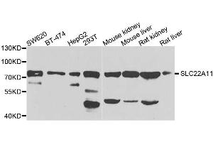 Western blot analysis of extracts of various cell lines, using SLC22A11 antibody. (SLC22A11 anticorps  (AA 40-150))