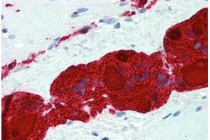 Human Small Intestine, Myenteric Plexus: Formalin-Fixed, Paraffin-Embedded (FFPE)