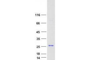 Validation with Western Blot