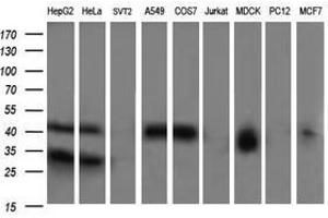 Image no. 4 for anti-Parvin, alpha (PARVA) antibody (ABIN1496446) (Parvin alpha anticorps)