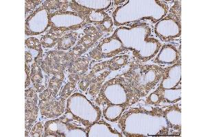 IHC analysis of Annexin A10/ANXA10 using anti-Annexin A10/ANXA10 antibody (ABIN7601853). (Annexin a10 anticorps  (AA 49-324))