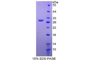SDS-PAGE (SDS) image for Inhibin Binding Protein (INHBP) (AA 1008-1227) protein (His tag) (ABIN2125252) (IGSF1 Protein (AA 1008-1227) (His tag))