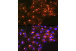 Immunofluorescence analysis of C6 cells using Cation-independent Cation-independent M6PR (IGF2R) (IGF2R) Rabbit mAb (ABIN1678848, ABIN3018066, ABIN3018067 and ABIN7101574) at dilution of 1:100 (40x lens).