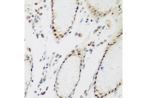 Immunohistochemistry of paraffin-embedded human gastric using PPAN antibody at dilution of 1:200 (40x lens). (PPAN anticorps)