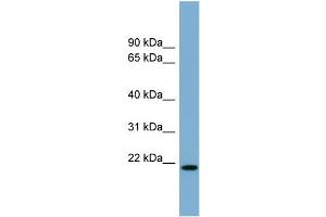 WB Suggested Anti-CYBA Antibody Titration:  0. (CYBA anticorps  (Middle Region))