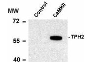 Image no. 1 for anti-Tryptophan Hydroxylase 1 (TPH1) (pSer19) antibody (ABIN303965) (Tryptophan Hydroxylase 1 anticorps  (pSer19))