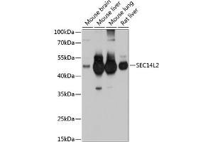 Western blot analysis of extracts of various cell lines, using SEC14L2 antibody (ABIN6132639, ABIN6147484, ABIN6147485 and ABIN6214889) at 1:1000 dilution. (SEC14L2 anticorps  (AA 60-270))