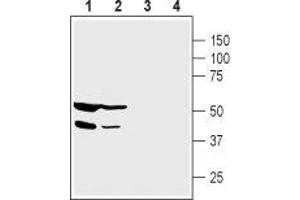 Western blot analysis of human PANC-1 pancreatic carcinoma cell lysate (lanes 1 and 3) and human HepG2 liver carcinoma cell lysate (lanes 2 and 4): - 1,2. (PICK1 anticorps  (alpha-helix Domain, Intracellular))