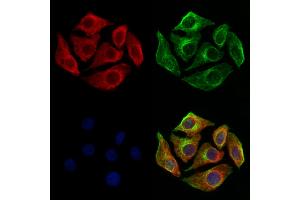 ABIN6260842 and ABIN6273209 staining Hela cells by IF/ICC. (SH3KBP1 anticorps  (N-Term))