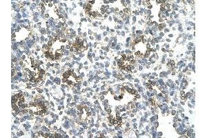 Rabbit Anti-SUV39H1 antibody   Paraffin Embedded Tissue: Human Lung cell Cellular Data: alveolar cell of renal tubule Antibody Concentration: 4. (SUV39H1 anticorps  (N-Term))