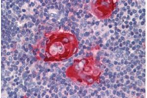 Human Thymus: Formalin-Fixed, Paraffin-Embedded (FFPE)