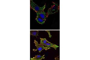 Immunofluorescence analysis of NTERA-2 cells (upper) and U251 (bottom) cells using KLHL13 monoclonal antibody, clone 8D1  (green) . (KLHL13 anticorps)