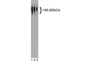 Western Blotting (WB) image for anti-Nestin (NES) antibody (ABIN967492) (Nestin anticorps)