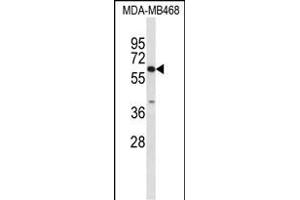 Western blot analysis of CES7 Antibody (Center) (ABIN653102 and ABIN2842692) in MDA-M cell line lysates (35 μg/lane). (CES5A anticorps  (AA 244-270))