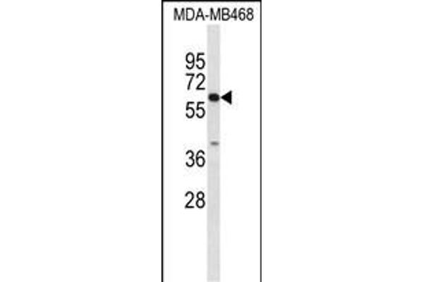 CES5A 抗体  (AA 244-270)