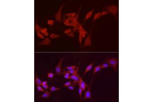 Immunofluorescence analysis of NIH/3T3 cells using /GSNOR Rabbit pAb (ABIN6131172, ABIN6136579, ABIN6136580 and ABIN6217464) at dilution of 1:50 (40x lens).
