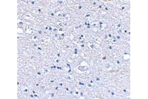 Immunohistochemical staining of human brain tissue using GRIK4 polyclonal antibody  at 2. (GRIK4 anticorps  (N-Term))