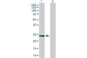 Western Blot analysis of SNAP23 expression in transfected 293T cell line by SNAP23 MaxPab polyclonal antibody. (SNAP23 anticorps  (AA 1-211))