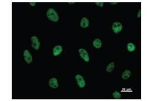 Immunostaining analysis in HeLa cells.
