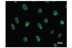 Immunostaining analysis in HeLa cells. (CDC5L anticorps)