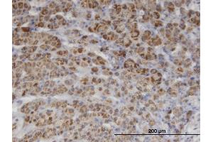 Immunoperoxidase of monoclonal antibody to PIK3C2A on formalin-fixed paraffin-embedded human adrenal gland. (PIK3C2A anticorps  (AA 1577-1686))