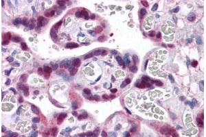 Human Placenta: Formalin-Fixed, Paraffin-Embedded (FFPE) (SMAD6 anticorps  (AA 285-385))